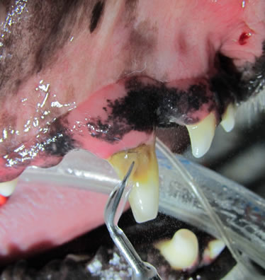 fratture-dentali-2